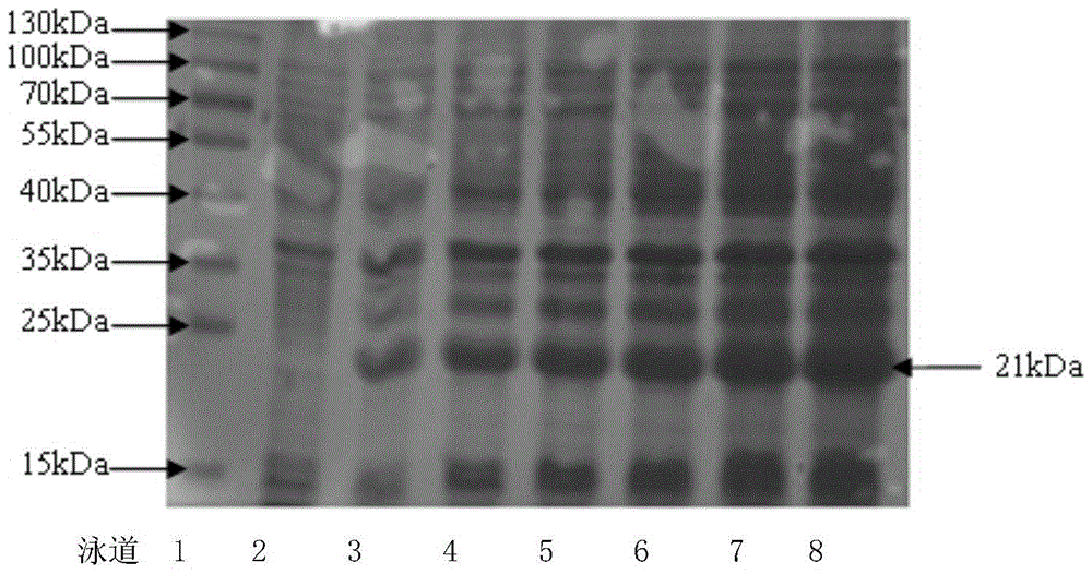 Human thymosin β4 triploid protein, coding gene and separation and purification method thereof