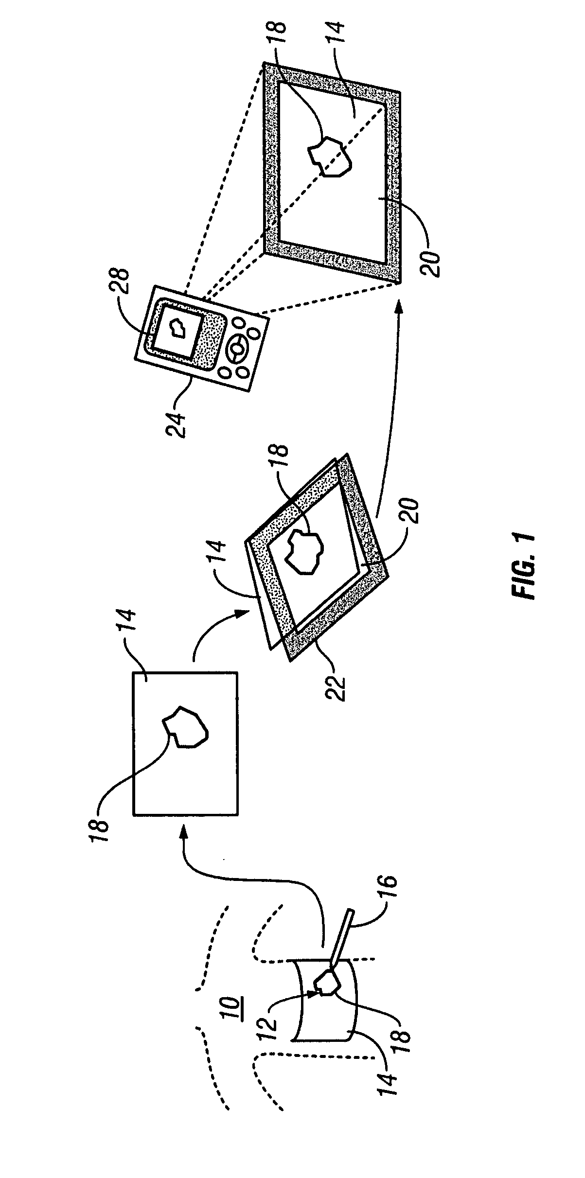 System and method for tracking healing progress of a wound