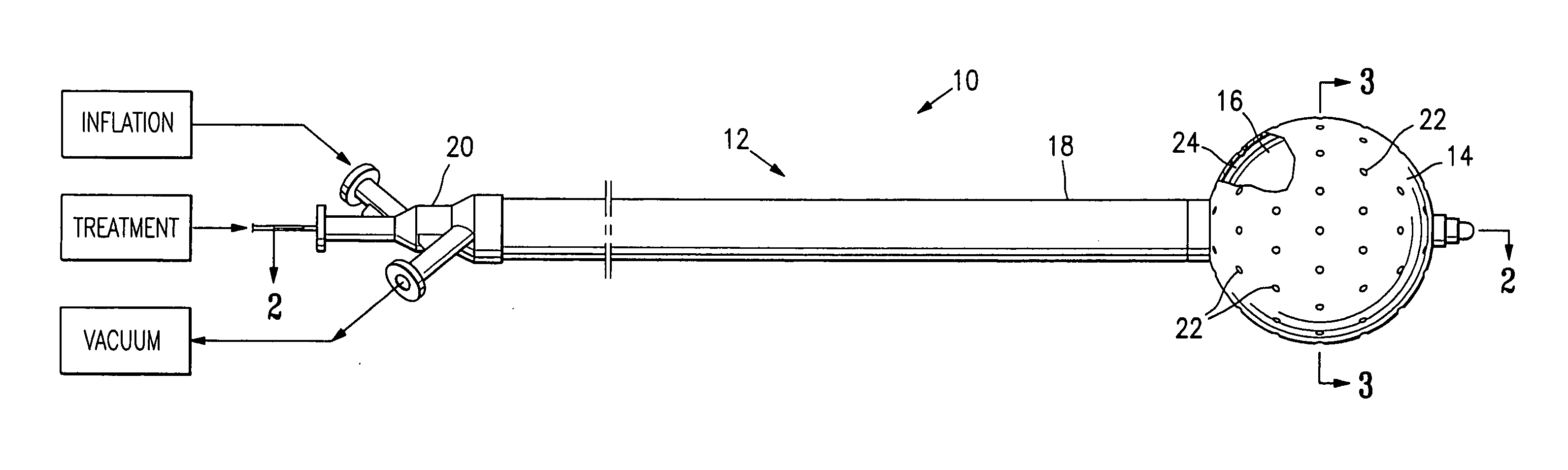 Vacuum device and method for treating tissue adjacent a body cavity