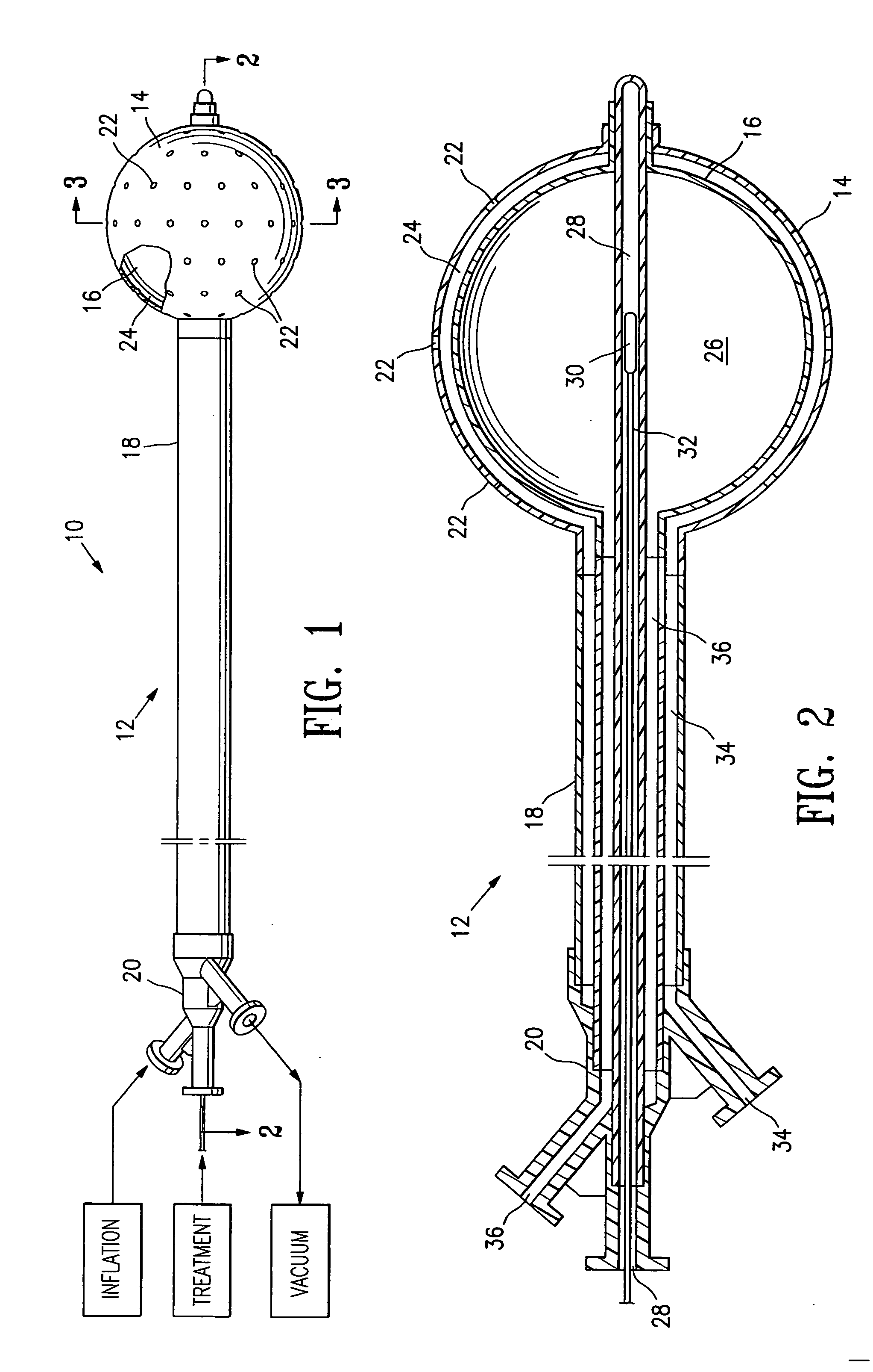 Vacuum device and method for treating tissue adjacent a body cavity