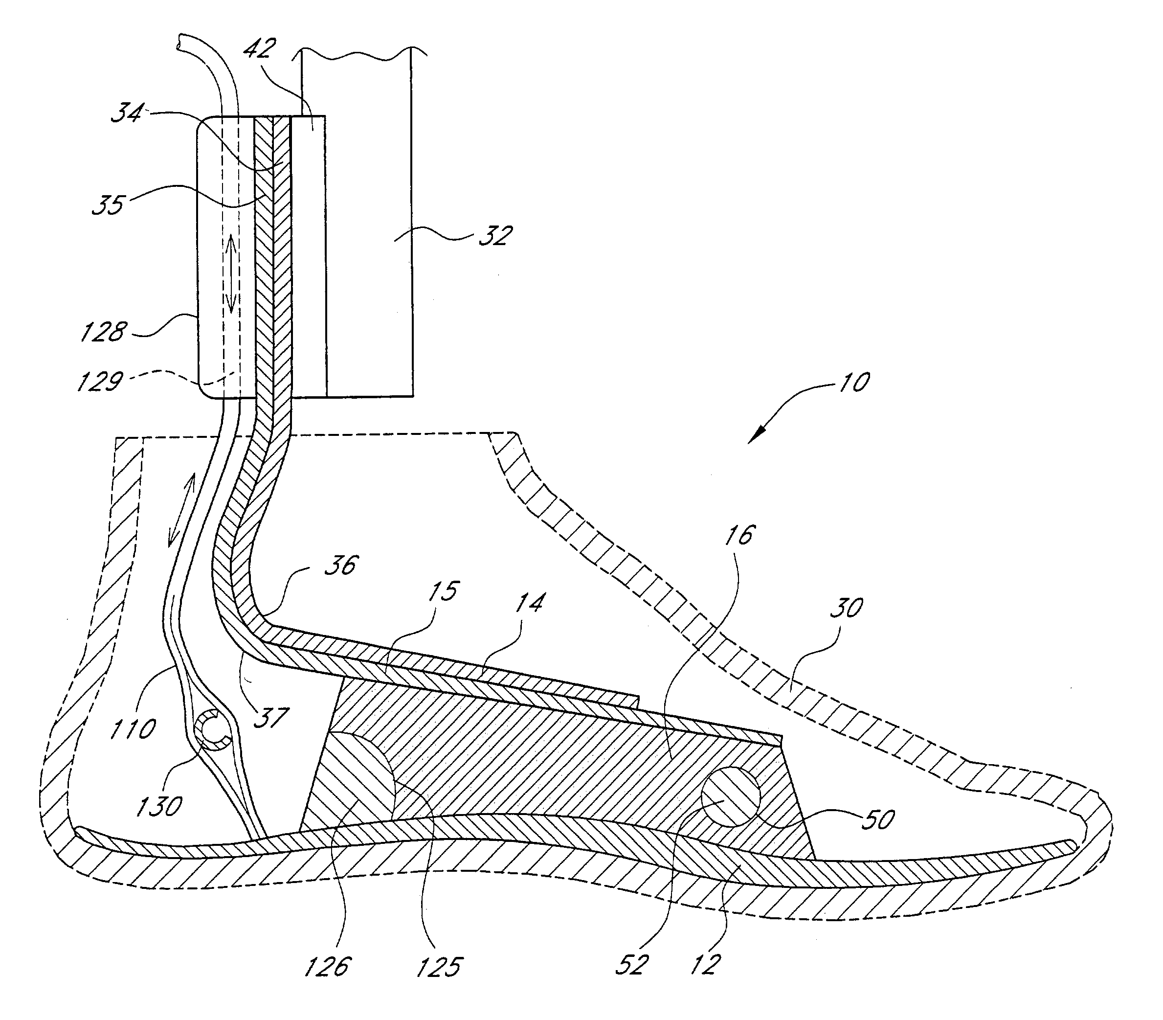 Foot prosthesis having cushioned ankle