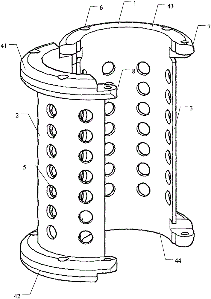 External vascular stent for relieving left renal vein compression and manufacturing method thereof