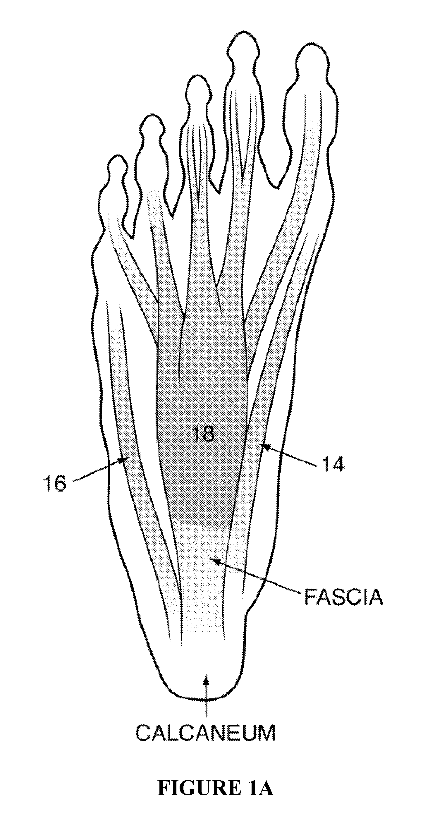 Method and apparatus for noninvasive inhibition of deep vein thrombosis