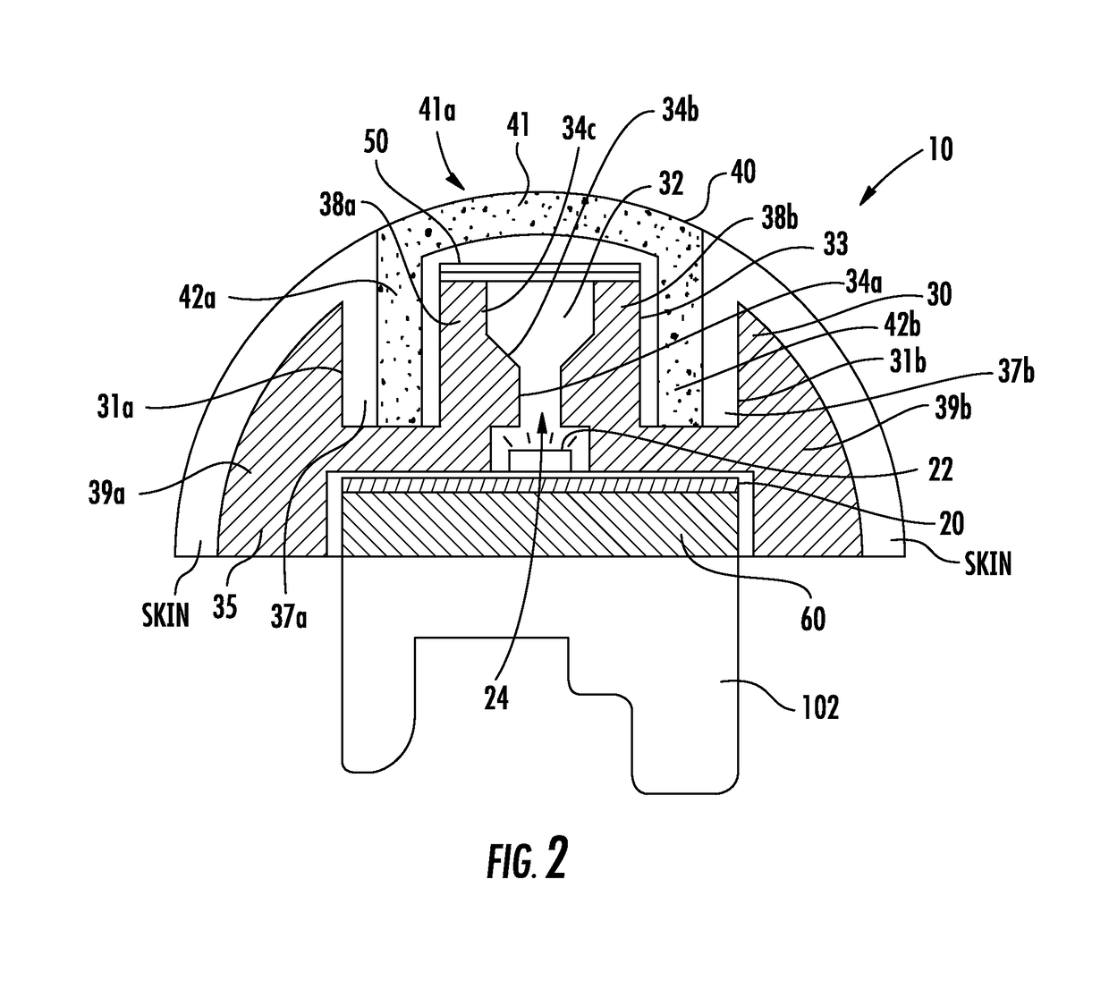 Steering grip light bar systems