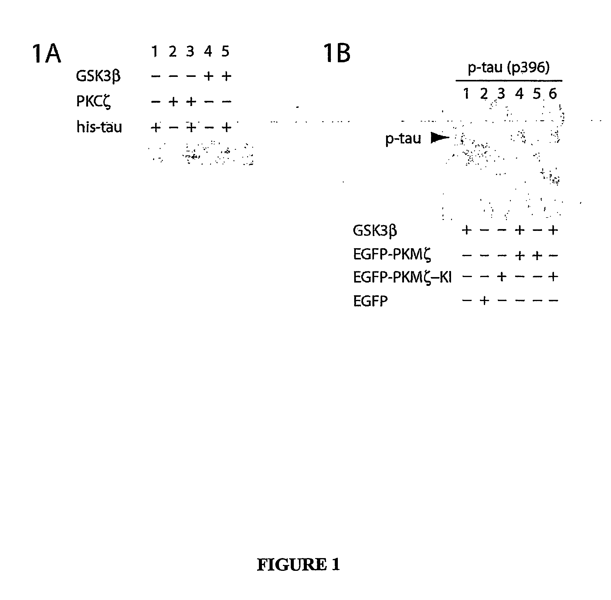 Atypical protein kinase c isoforms in disorders of the nervous system and cancer