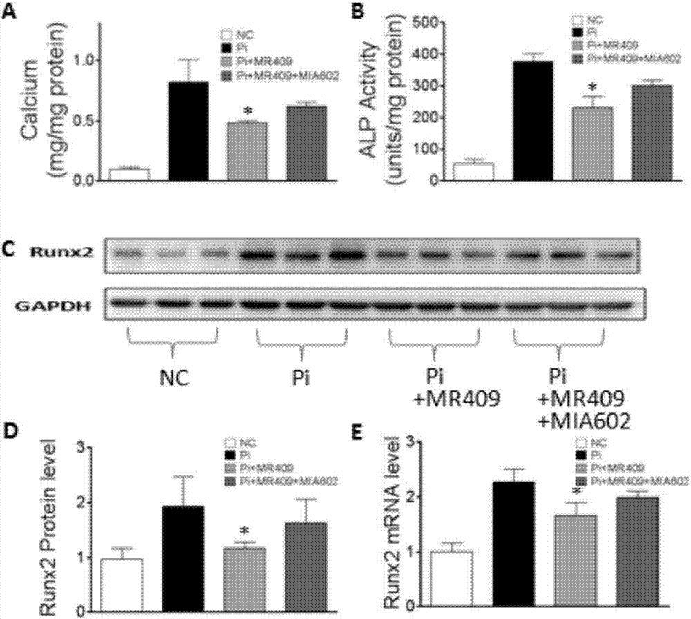 Applications of growth hormone release hormone agonist in preparation of anti-vascular calcification drugs