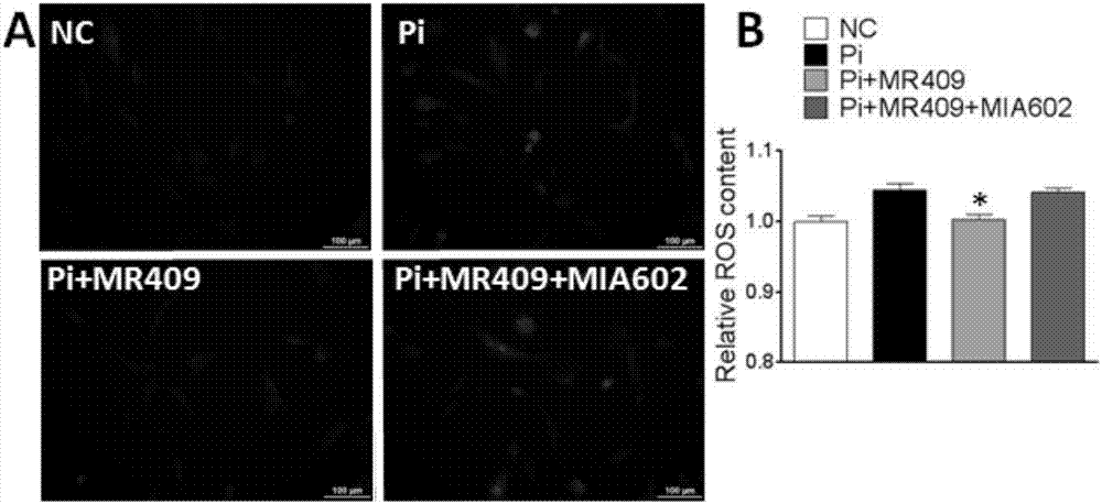 Applications of growth hormone release hormone agonist in preparation of anti-vascular calcification drugs