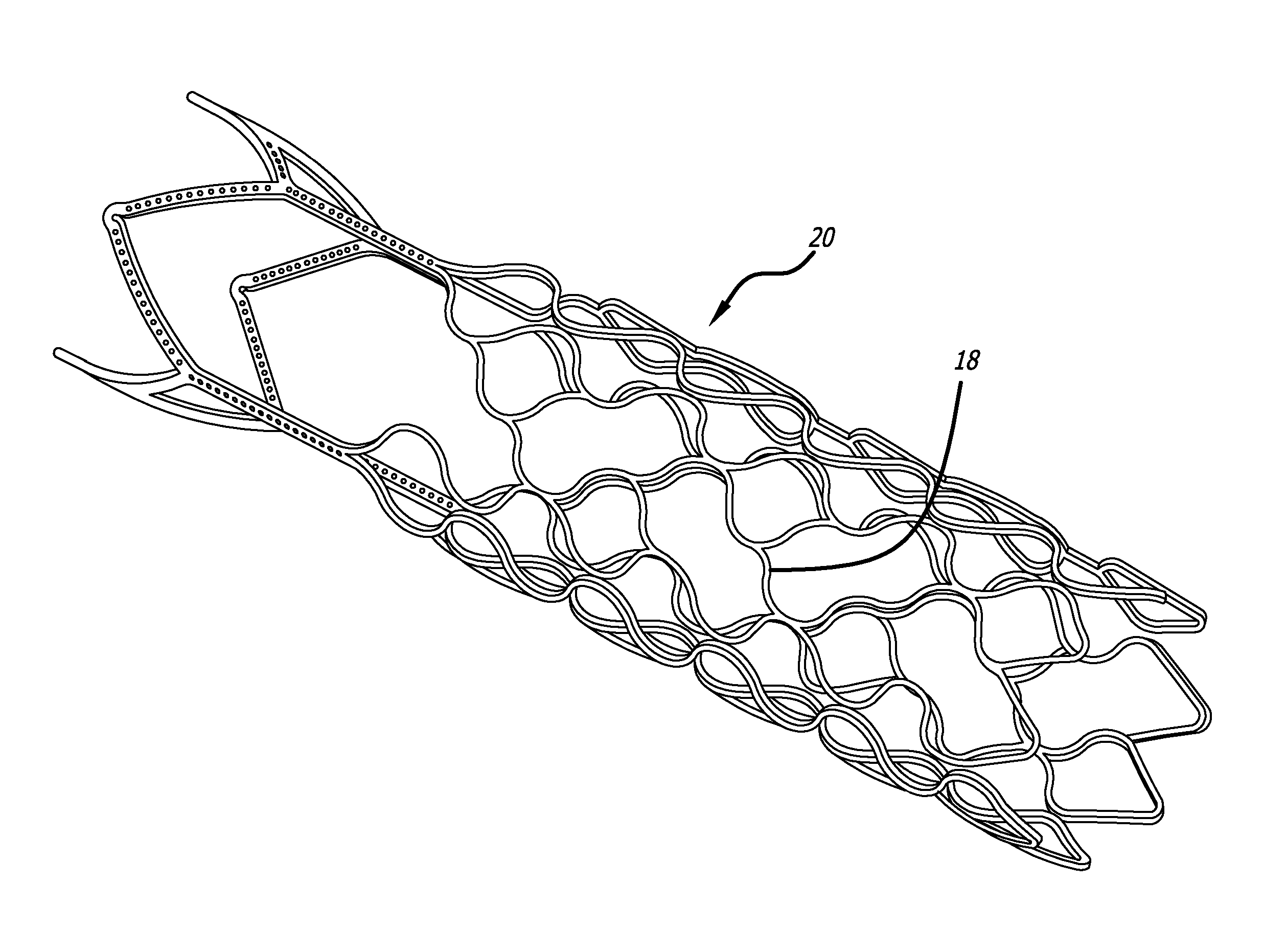 Methods and devices for treatment of vascular defects