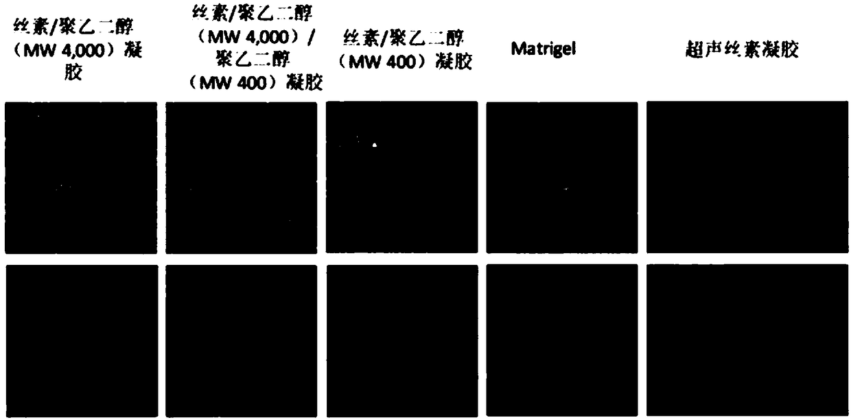 Silk fibroin hydrogel