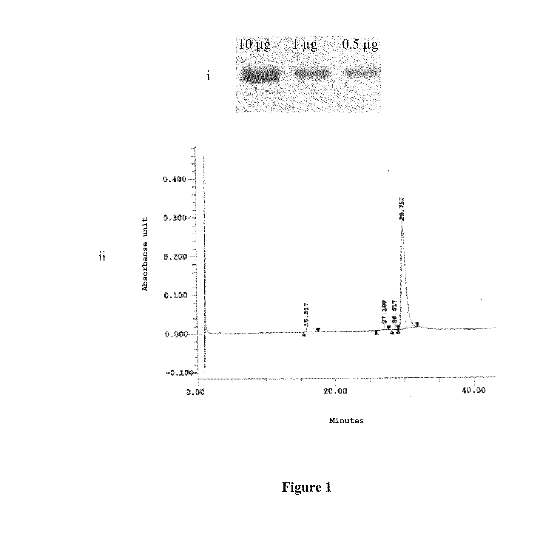 Vaccine against malaria, based on the 200l subuniti of plasmodium vivax msp1 protein