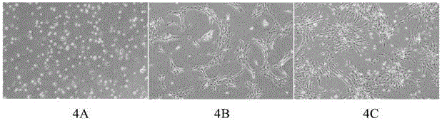 Kit for culturing hUC-MSC step by step and hUC-MSC obtained by adopting same