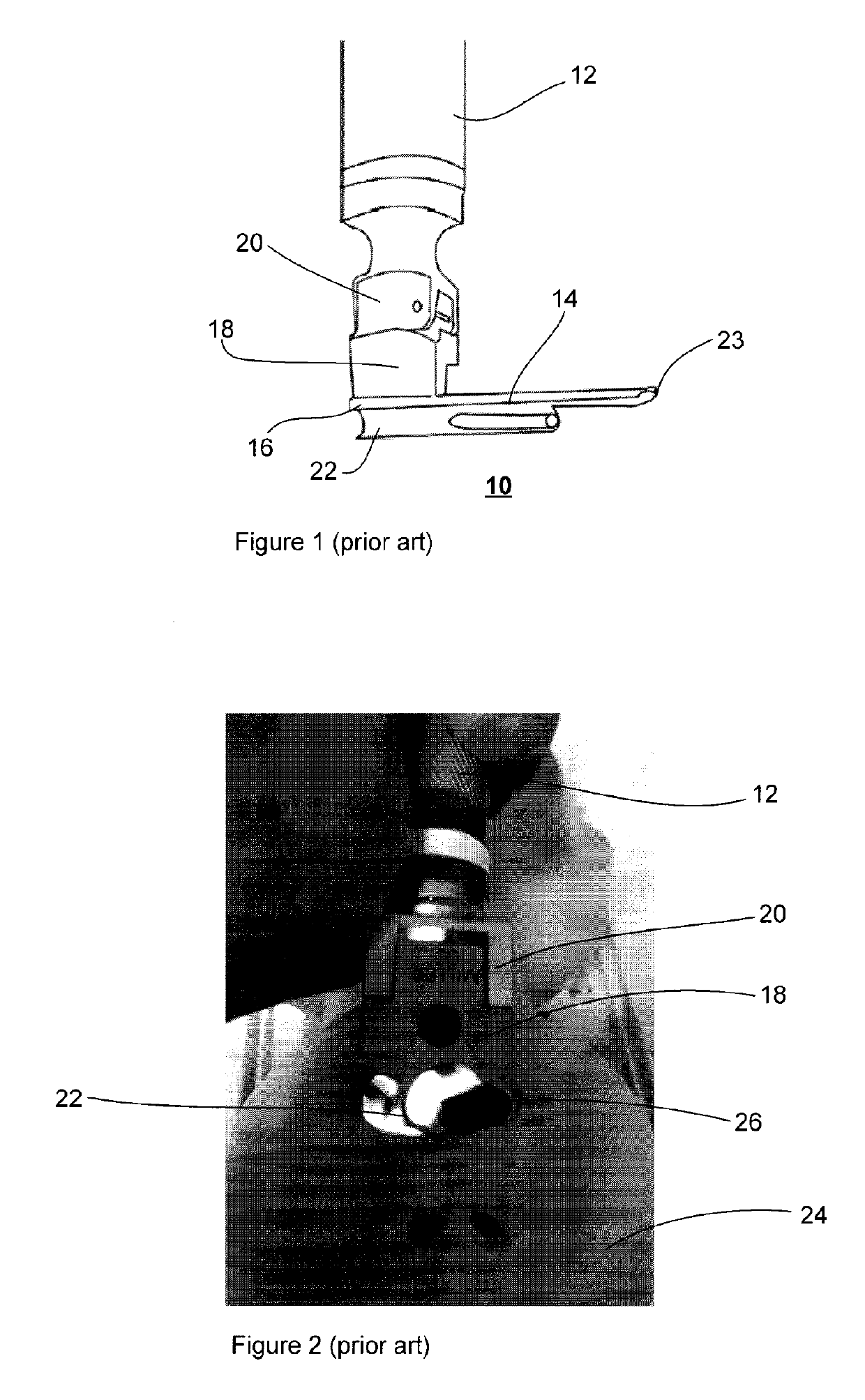 Pediatric laryngoscope, and method of use