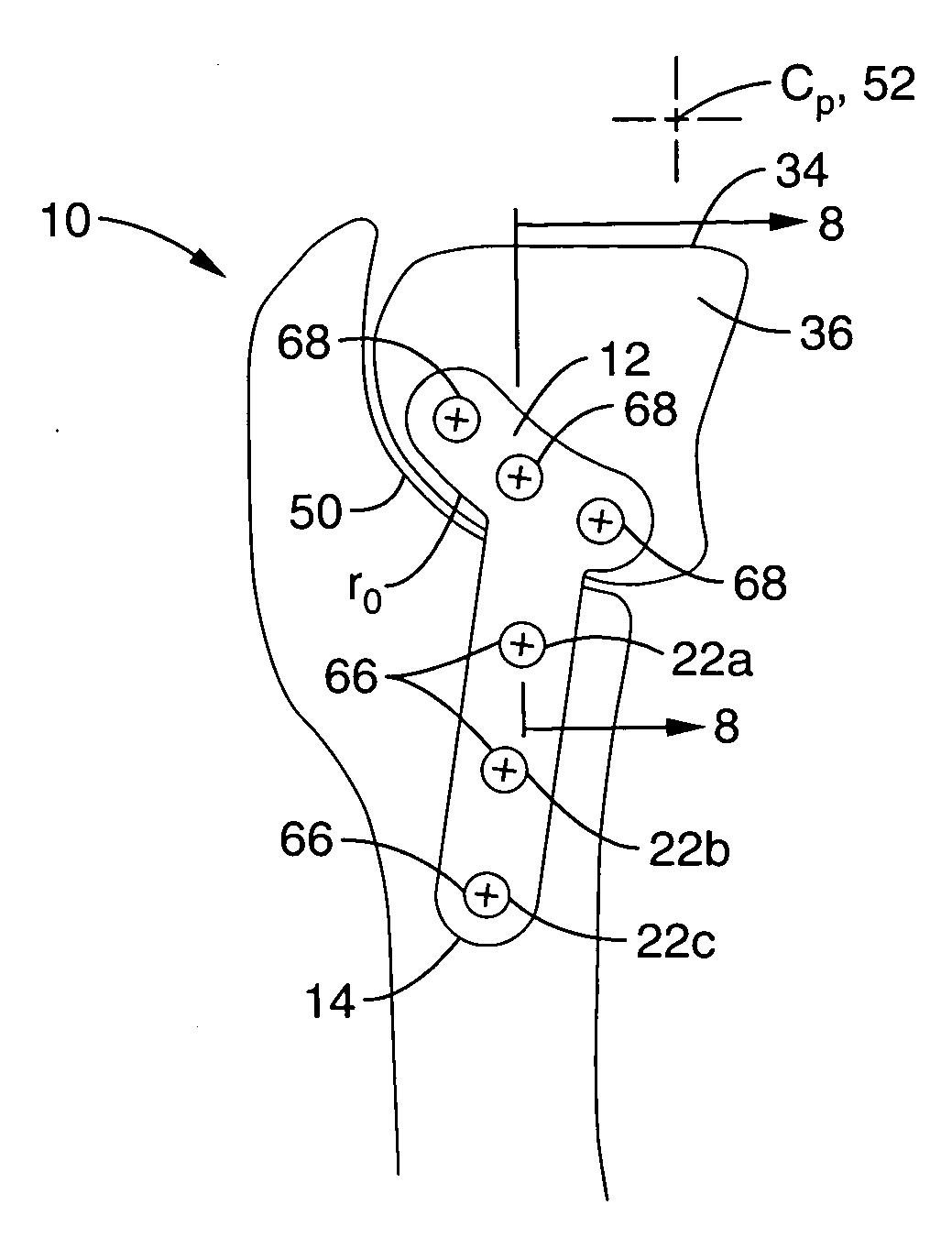 Apparatus and methods for tibial plateau leveling osteotomy