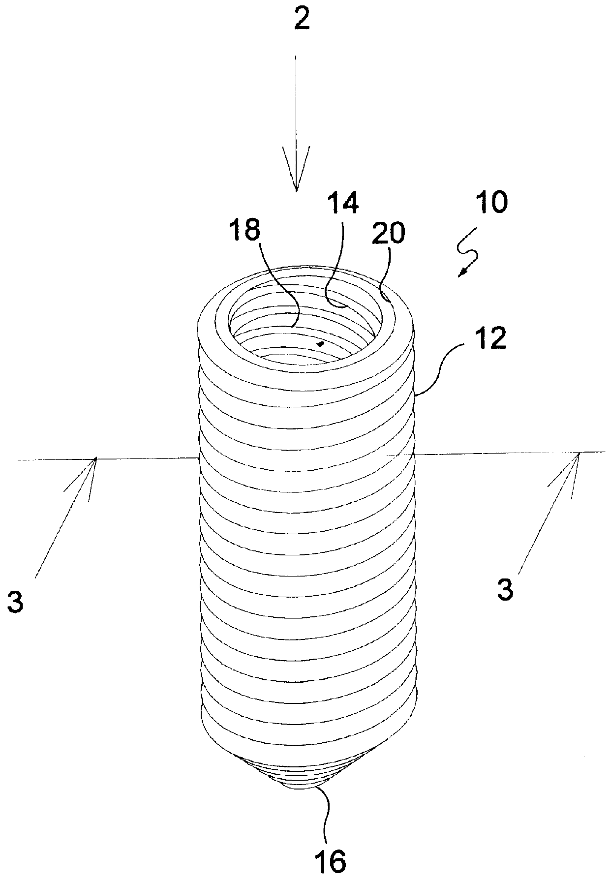 Method and apparatus for a prosthetic ligament