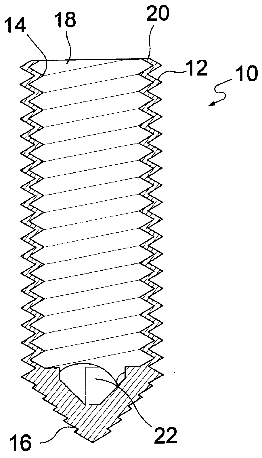 Method and apparatus for a prosthetic ligament