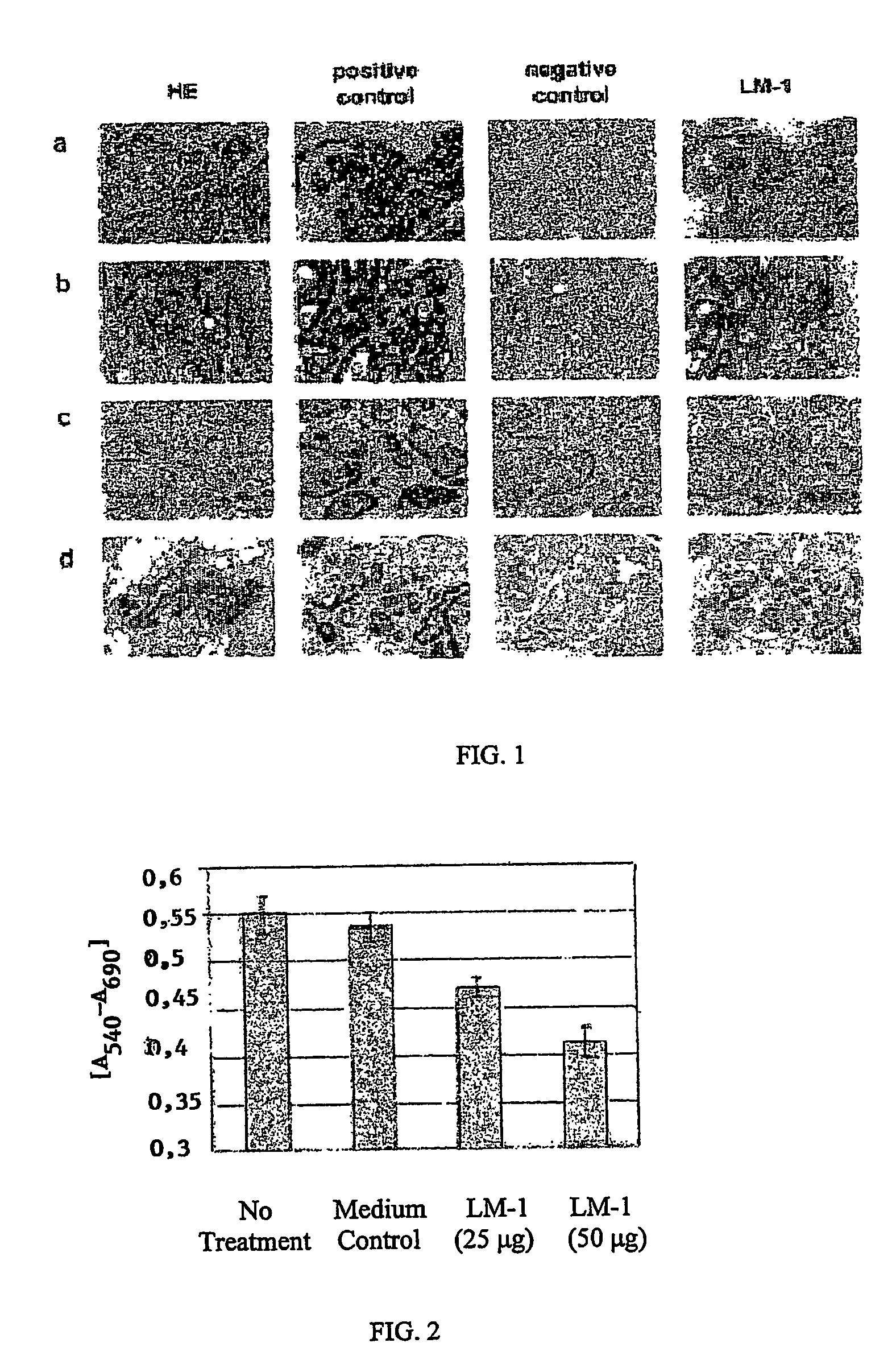 Neoplasm specific antibodies and uses thereof