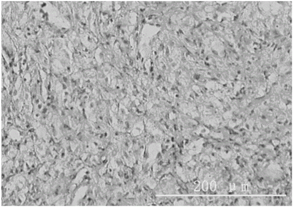 Method for preparing tissue engineering-oriented artificial tendon transplant based on artificial tendon scaffold material