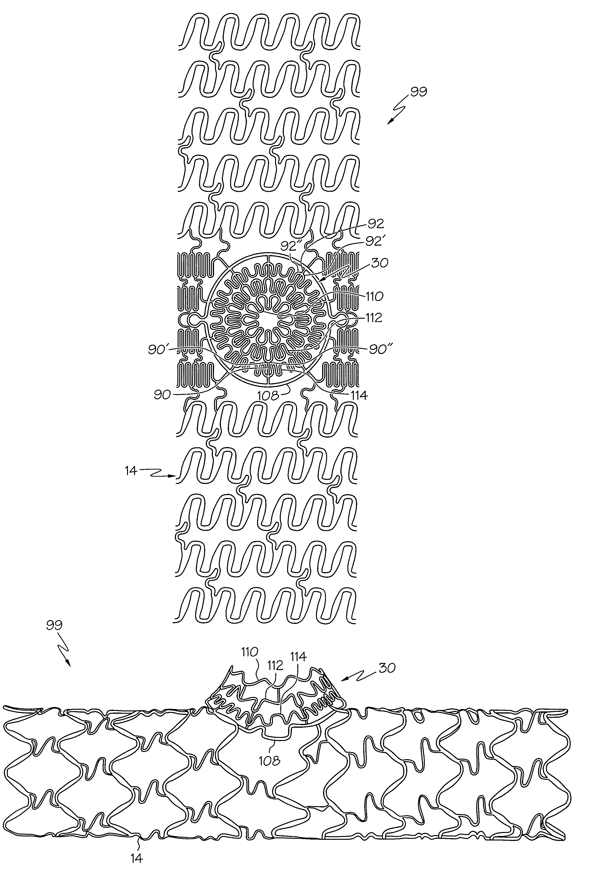 Stent with protruding branch portion for bifurcated vessels