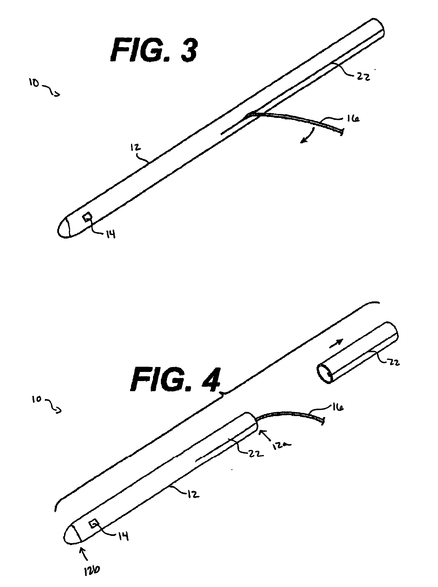 Trimmable sensing catheter