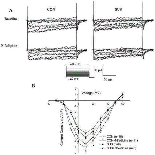 Application of nifedipine to preparation of medicine for preventing brain blood vessel injury caused by zero gravity