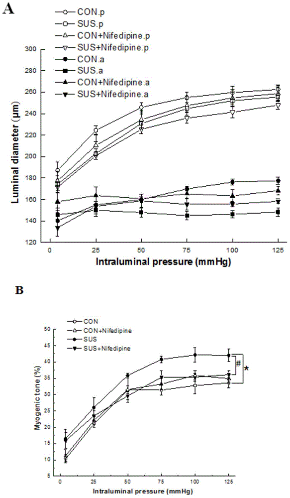 Application of nifedipine to preparation of medicine for preventing brain blood vessel injury caused by zero gravity