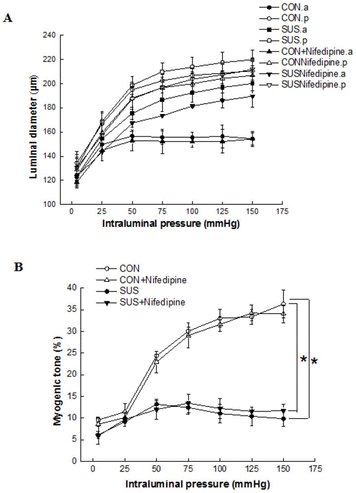 Application of nifedipine to preparation of medicine for preventing brain blood vessel injury caused by zero gravity