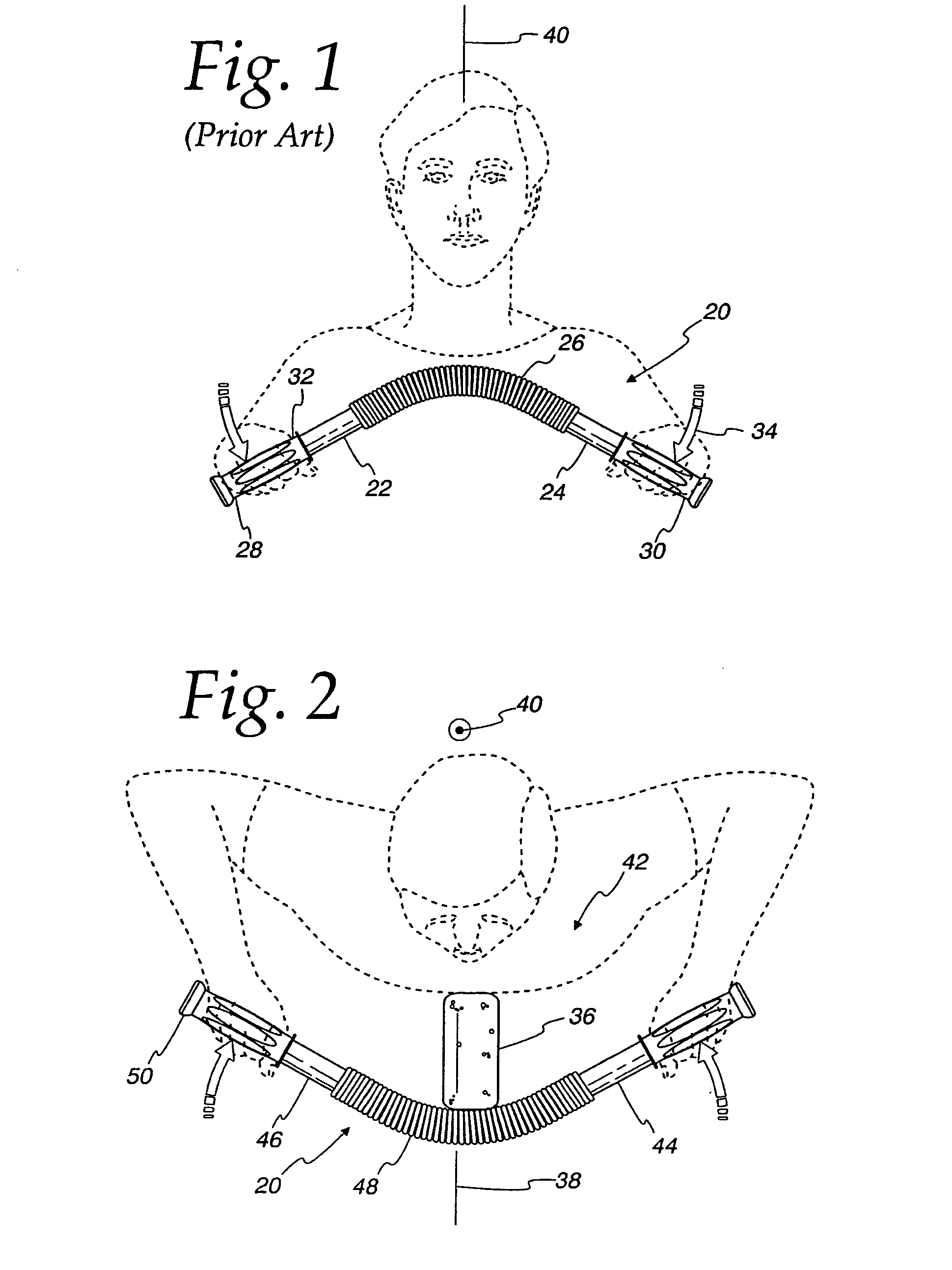 Exercise device and methods