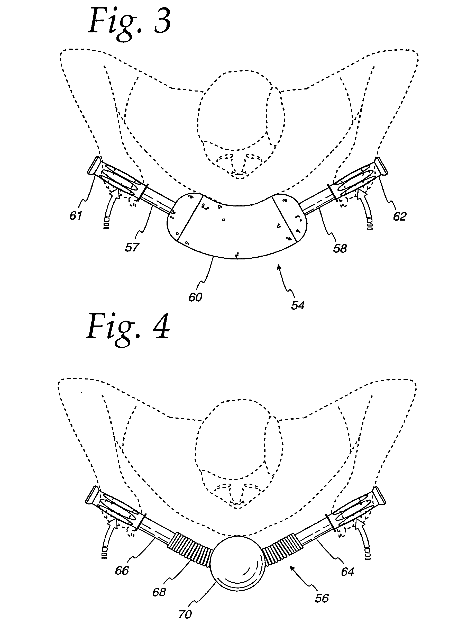 Exercise device and methods