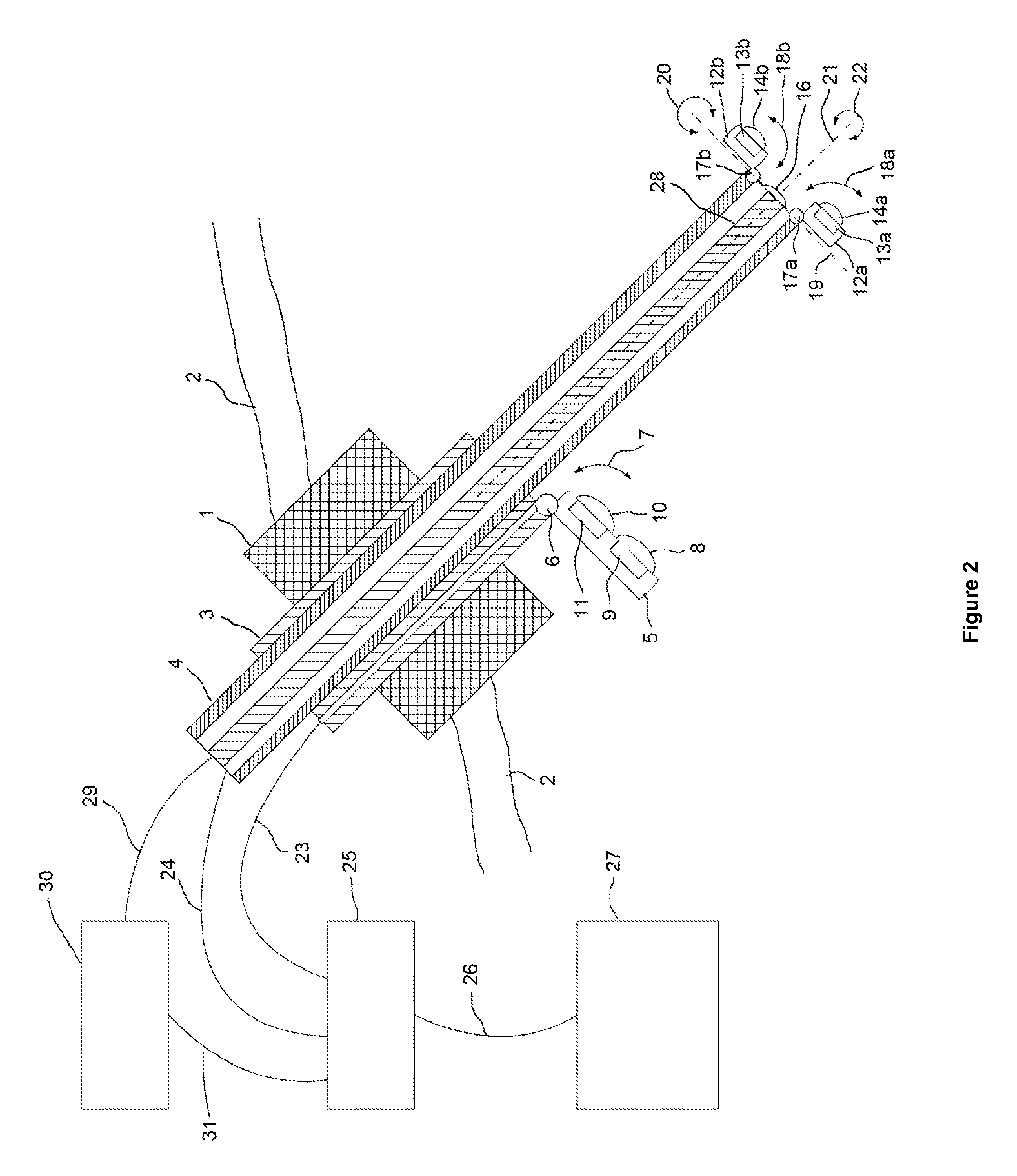 Endoscope comprising a system with multiple cameras for use in minimal-invasive surgery