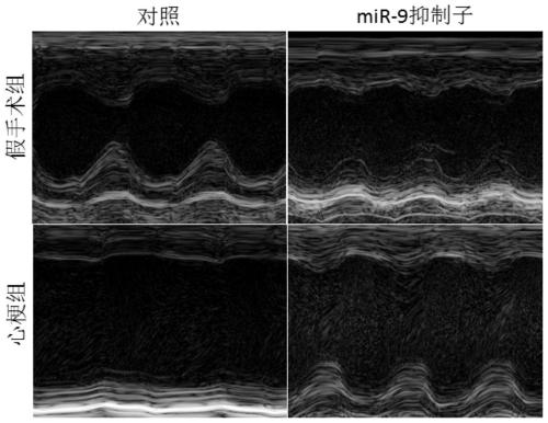 Application of miRNA inhibitor in the preparation of drugs for preventing and treating myocardial infarction