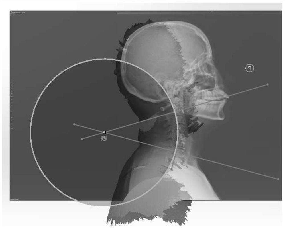 A kind of cervical vertebra pillow and its design method, design device, computer-readable storage medium