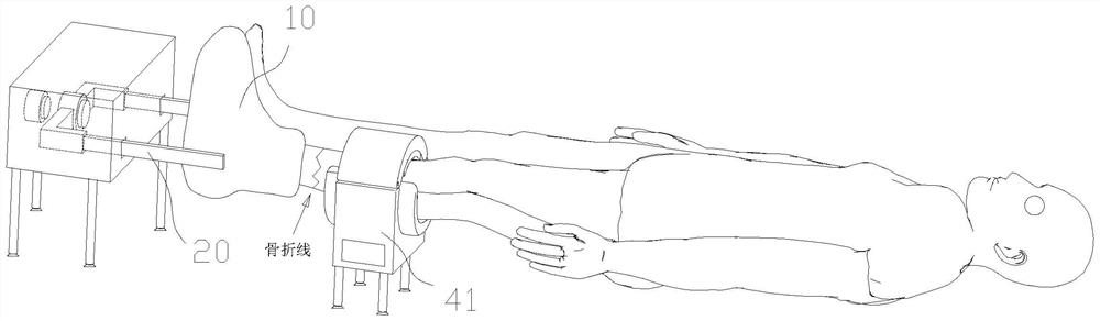 Traction-compression bidirectional device for promoting tibia fracture postoperative healing