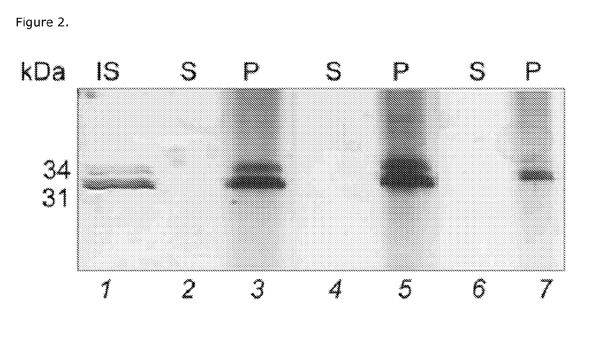 Borrelia burgdorferi bacterial antigen diagnosic test using polymeric bait containing capture particles