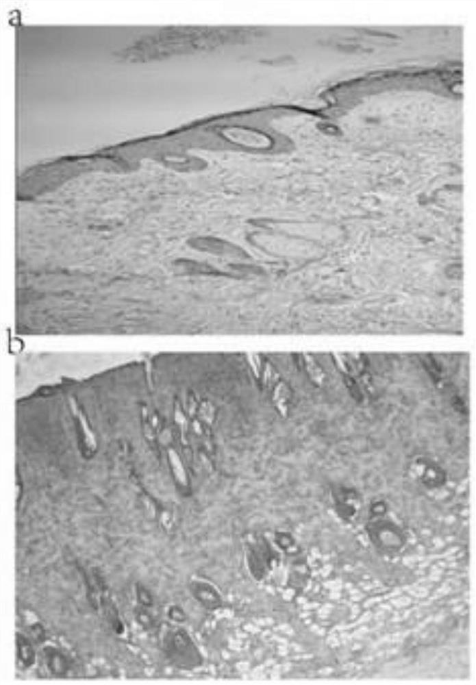 Application of Corilagin in preparation of medicine for treating burns and scalds