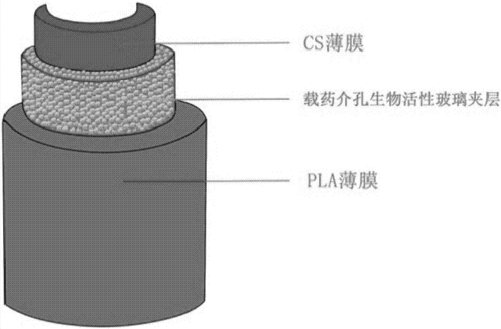 Sandwich type composite membrane stent