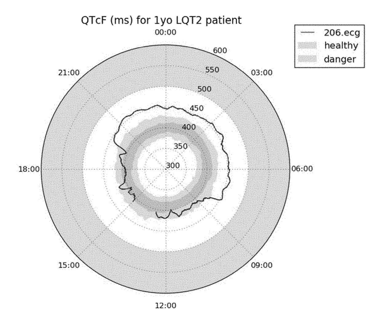 ECG clock electrocardiogram based diagnostic device and method