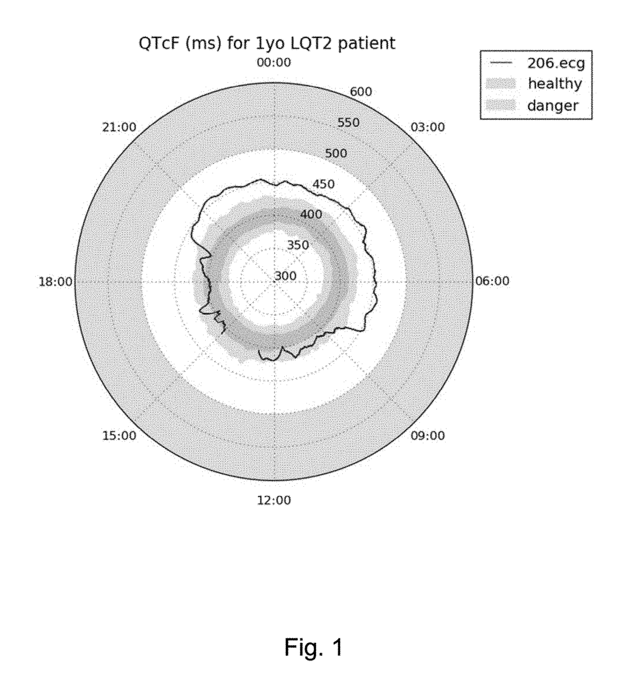 ECG clock electrocardiogram based diagnostic device and method