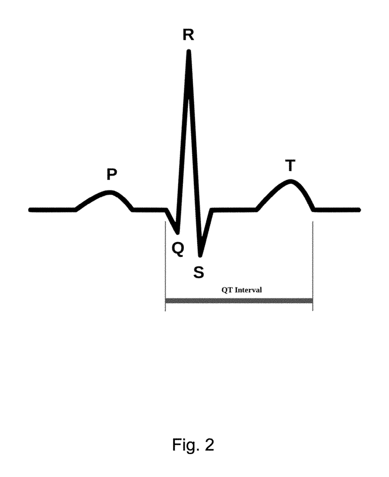 ECG clock electrocardiogram based diagnostic device and method