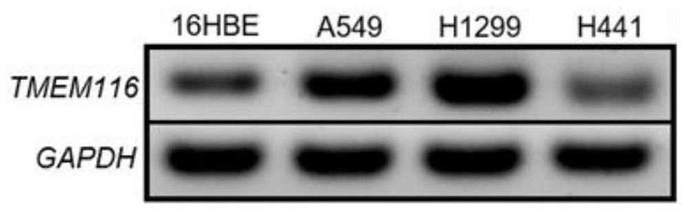 Molecular marker related to lung cancer proliferation and metastasis and application thereof