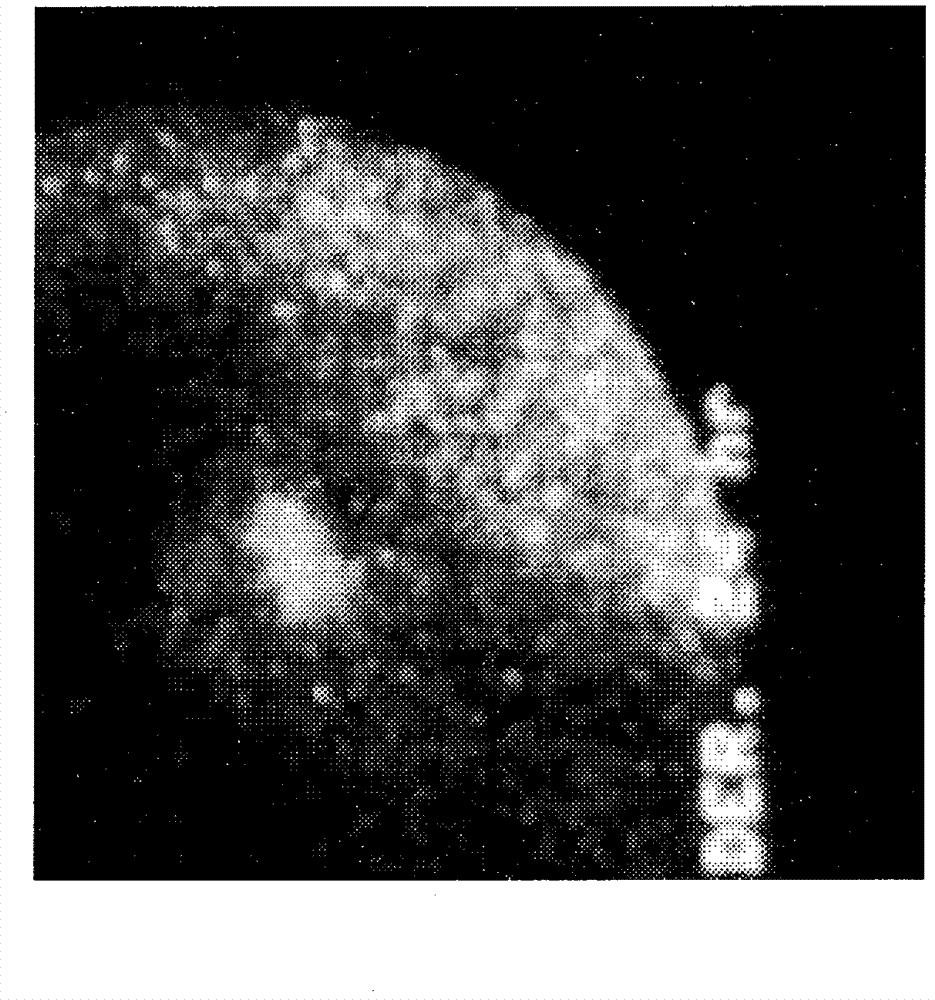 Modified hydroxypolymer conjugates with bone seeking and tumor killing moieties