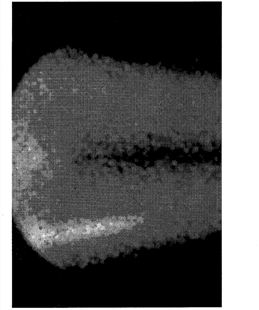 Modified hydroxypolymer conjugates with bone seeking and tumor killing moieties