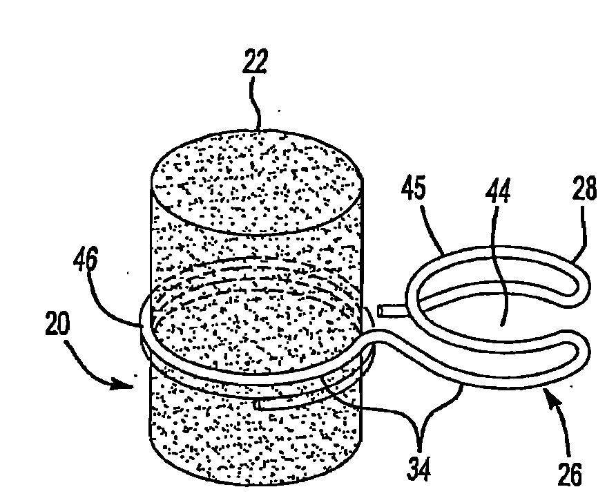 Improved middle ear implant and method