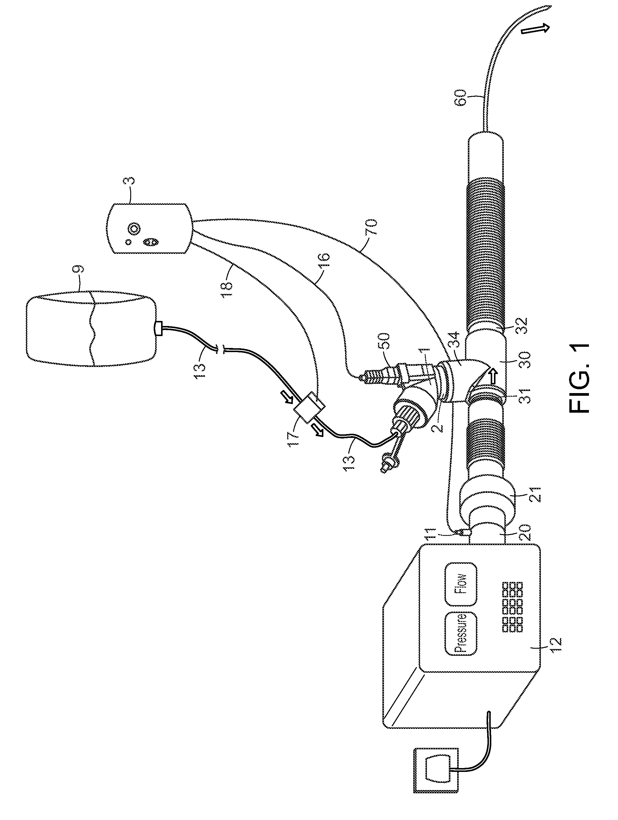 Insufflation of body cavities