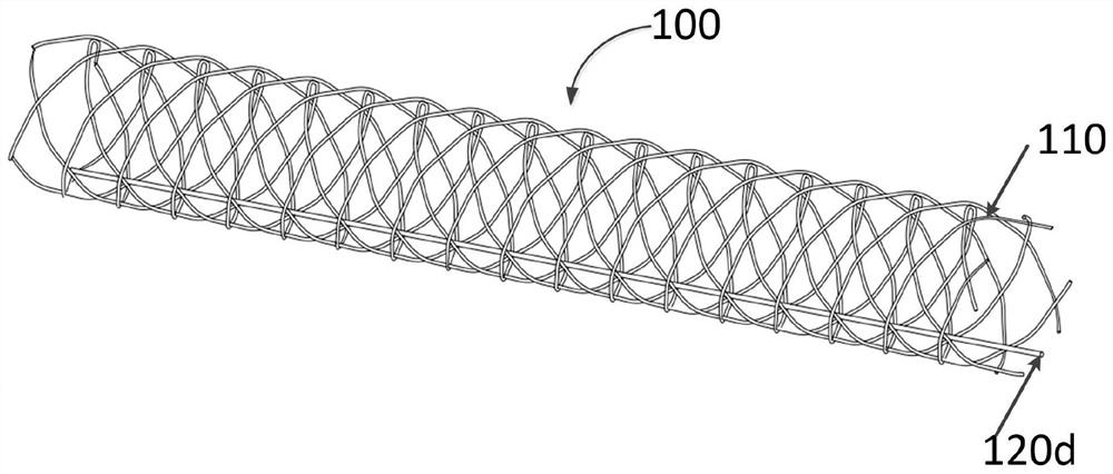 Catheter reinforcing layer and catheter