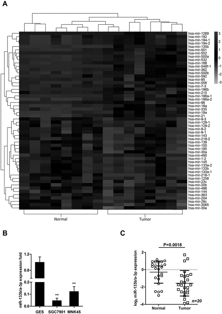 Applications of miR-133 micromolecular nucleic acid medicines in preparing medicines for resisting gastric cancer