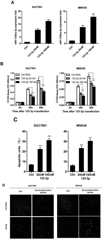 Applications of miR-133 micromolecular nucleic acid medicines in preparing medicines for resisting gastric cancer