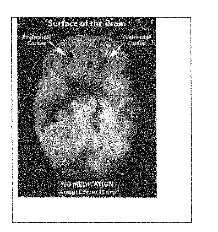 Methods and compositions for treatment of ADD/ADHD, depression, memory problems and other conditions