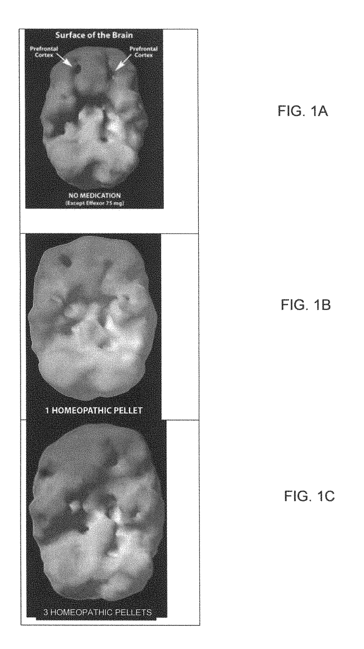 Methods and compositions for treatment of ADD/ADHD, depression, memory problems and other conditions