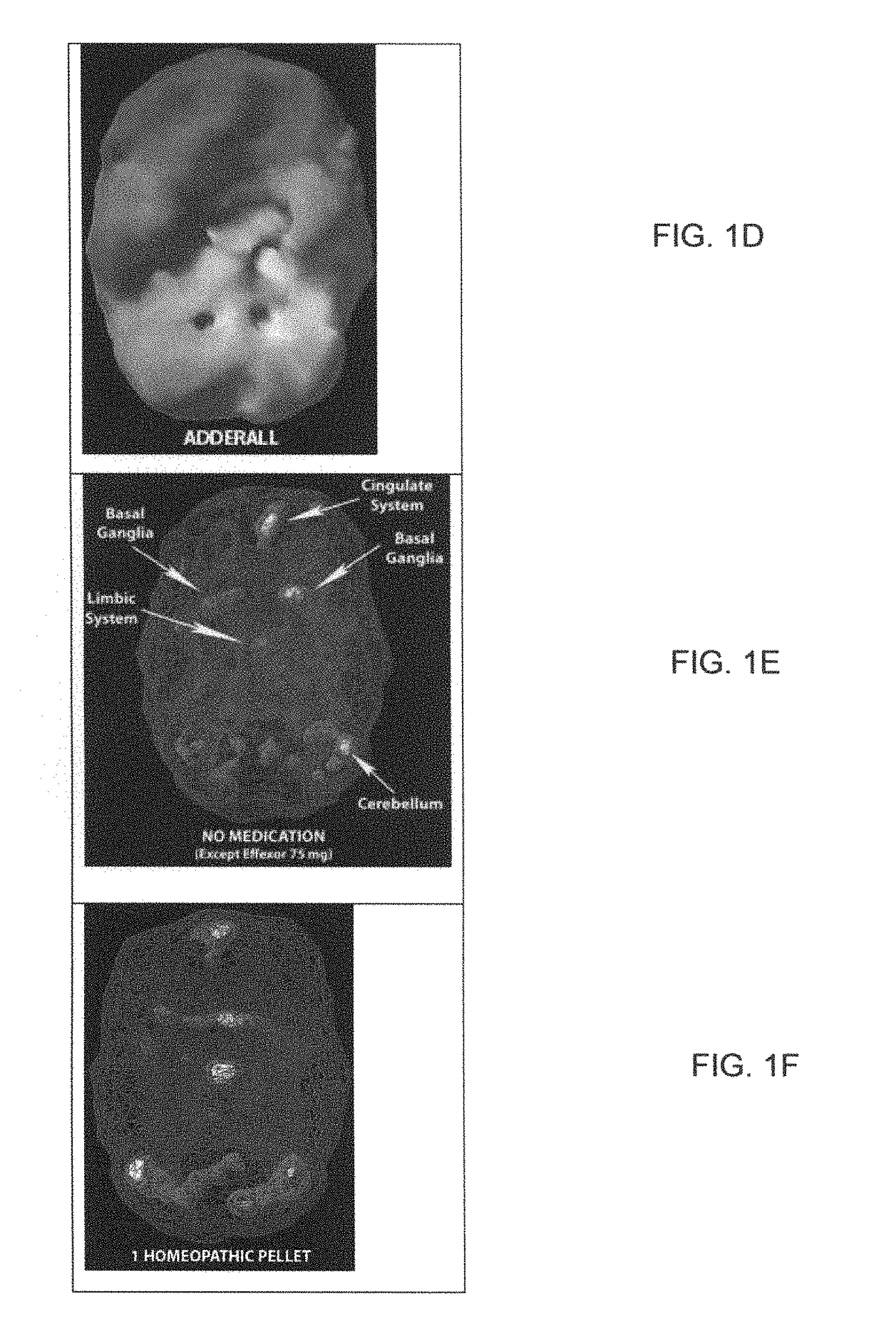 Methods and compositions for treatment of ADD/ADHD, depression, memory problems and other conditions