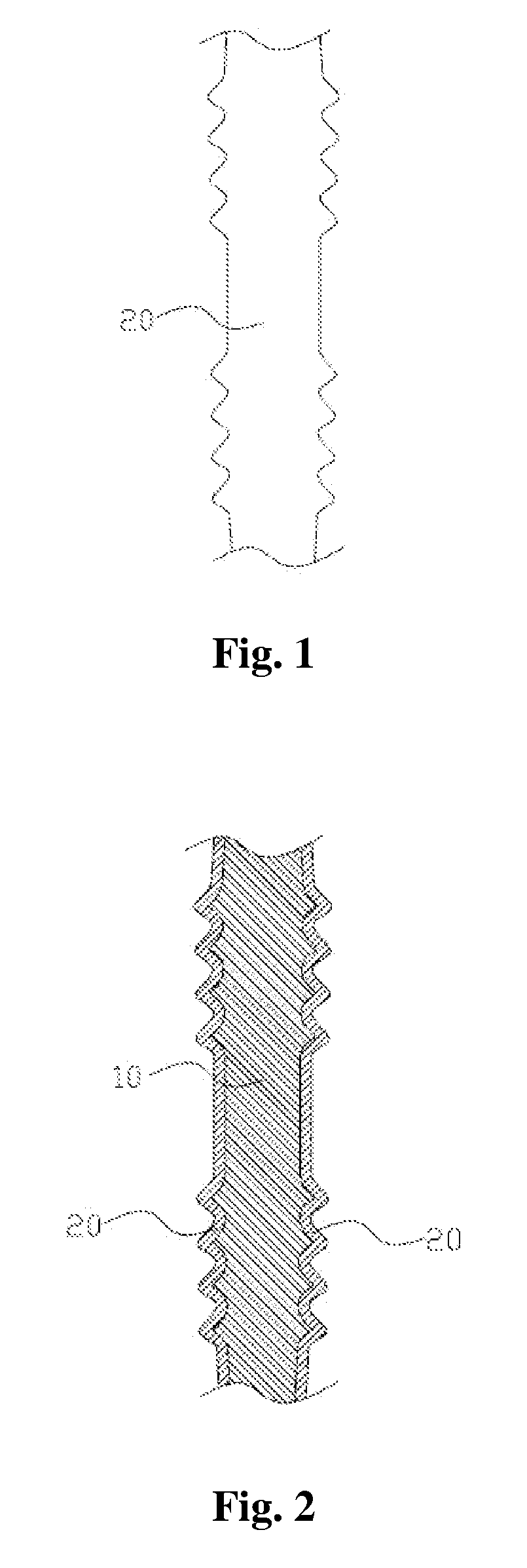 Composite metal article